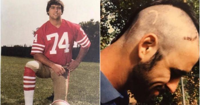 George Visger The NFLs Worst Nightmare George Visgers Battle With Brain