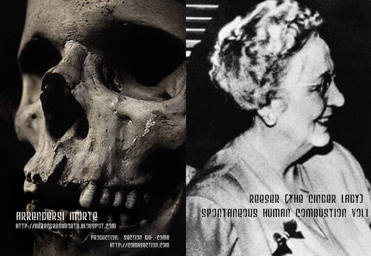 Mary Reeser Top 10 Unsolved Cases of Spontaneous Human Combustion