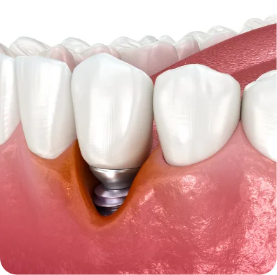 periodontist binghamton ny