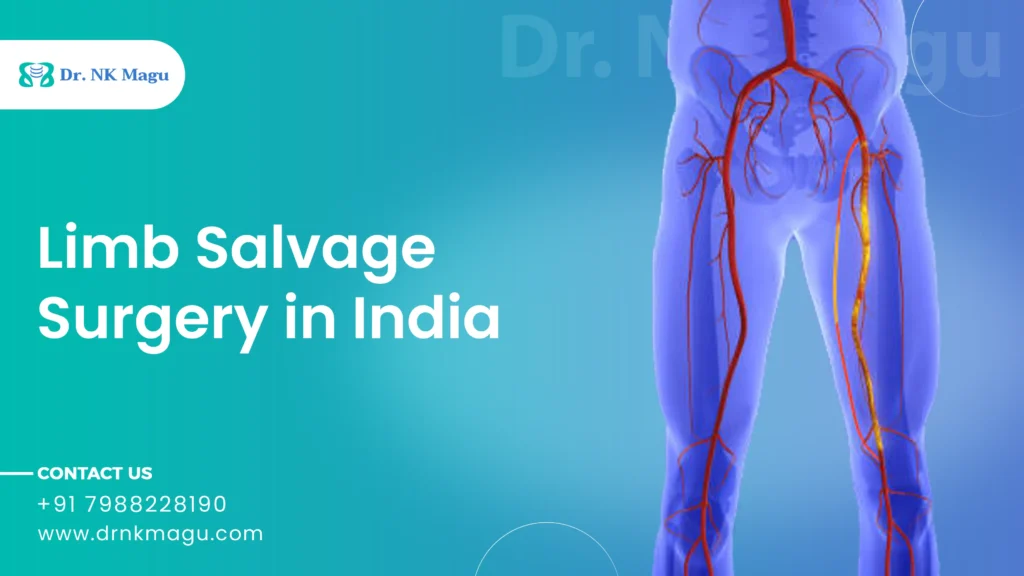 Limb Salvage Surgery Cost in India