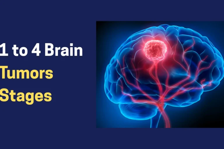 Stage 1 to Stage 4 Brain Tumors