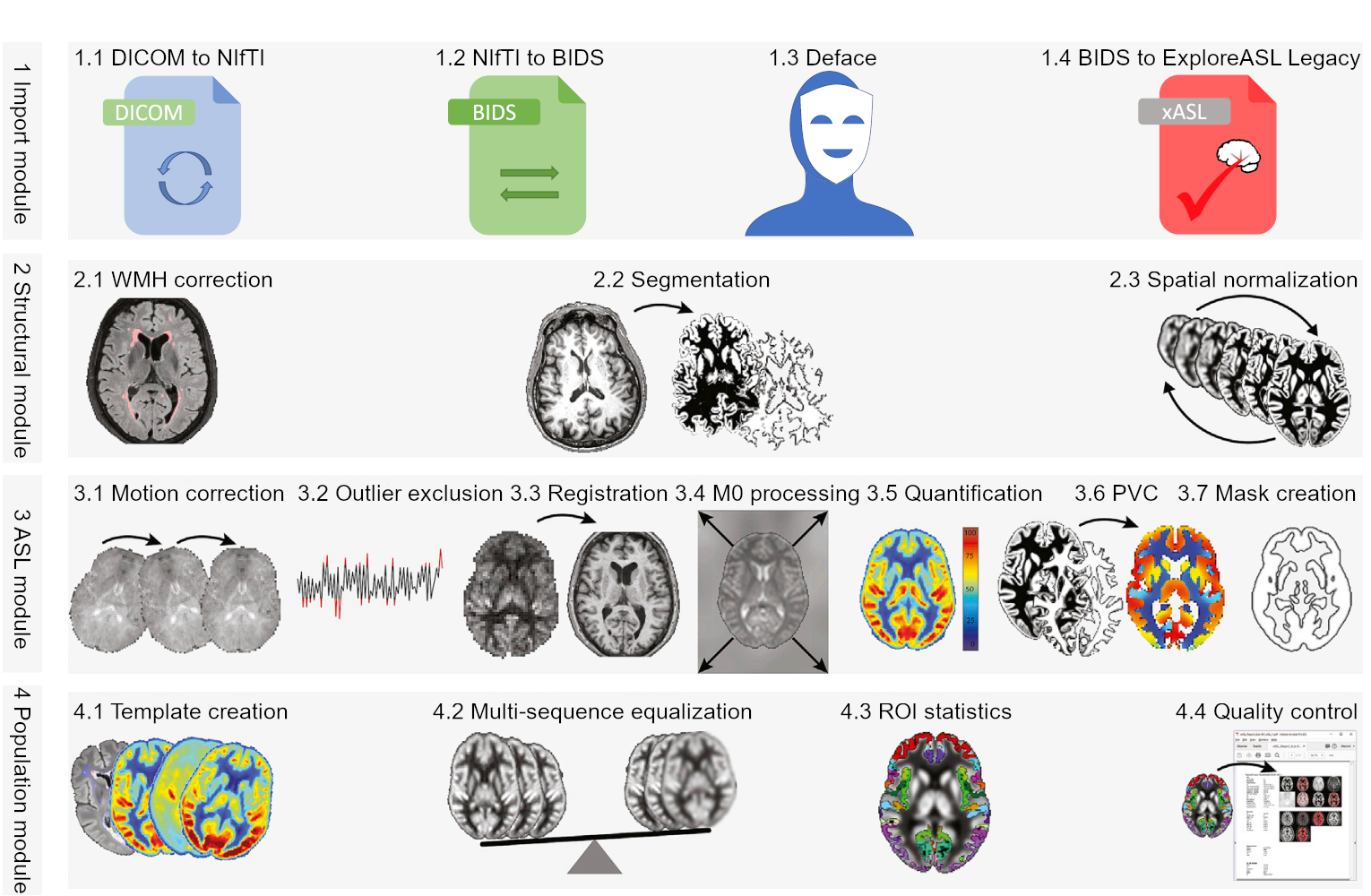 Workflow of ExploreASL ExploreASL Workflow