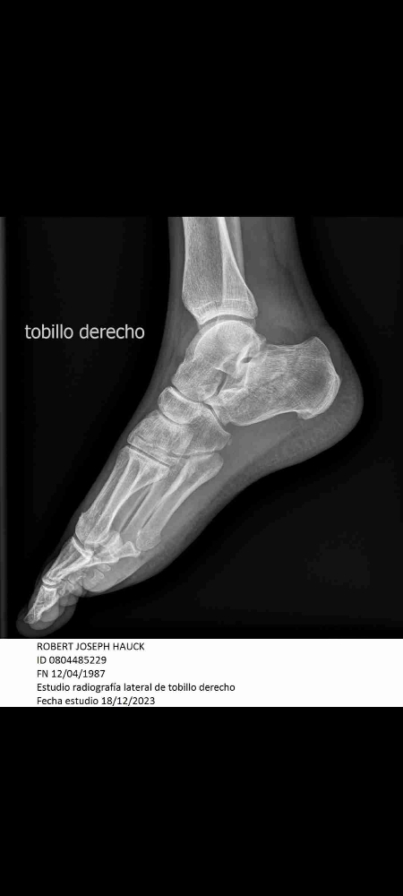 BJ (beeej97) Farcaster social identity (Fname handle) PFP