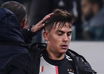 ساري لم أتحدث مع رونالدو عن ألم ركبته وديبالا من يصنع الفارق الآن