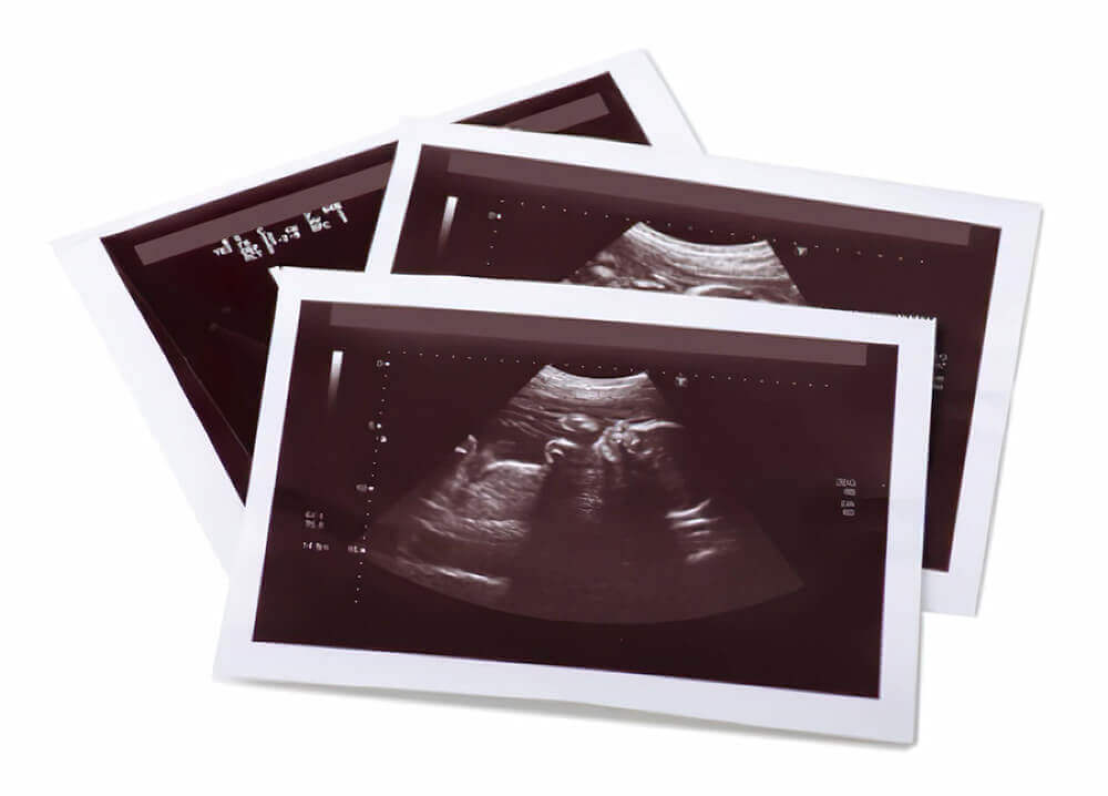 Panda Paper Roll Ultrasound Paper Panda Paper Roll Ultrasound Paper