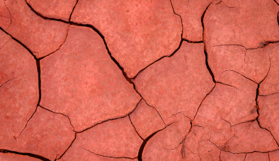 dehydrated skin