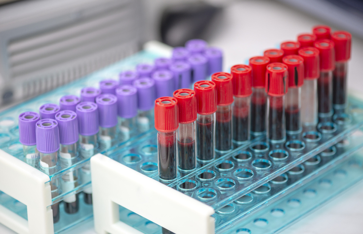 Blood Samples for Laboratory Testing and Diagnostic Analysis in UAE