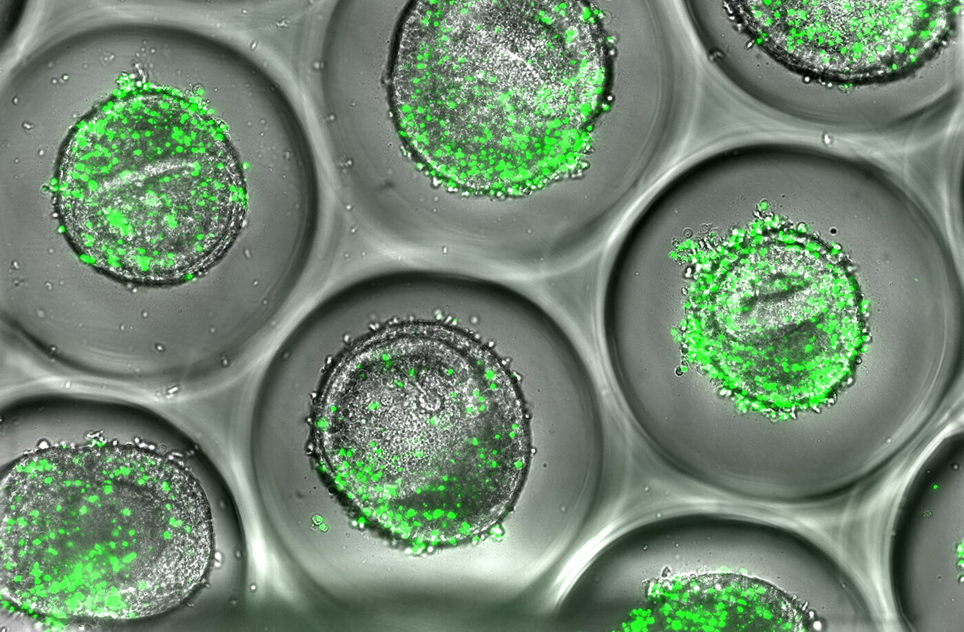 A-List_Liver-organoid 22222 (002) Liver Organoids